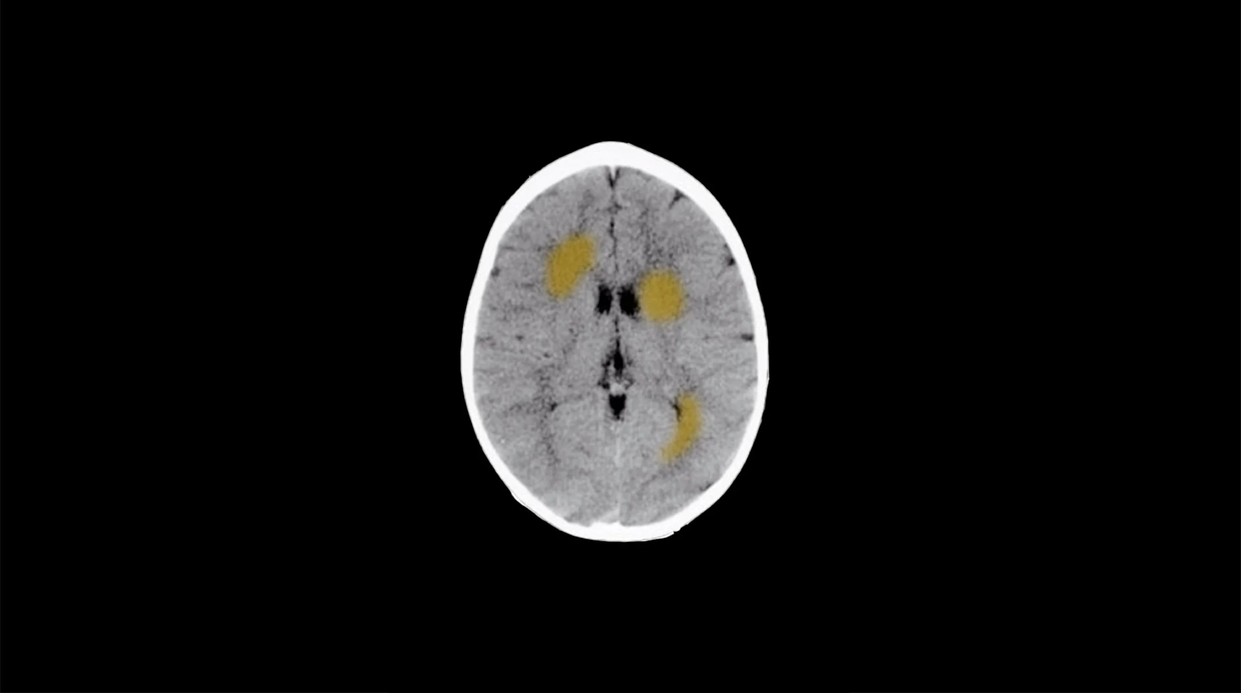 Addiction project cover